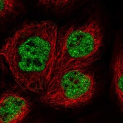 THRSP Antibody, Novus Biologicals:Antibodies:Primary Antibodies